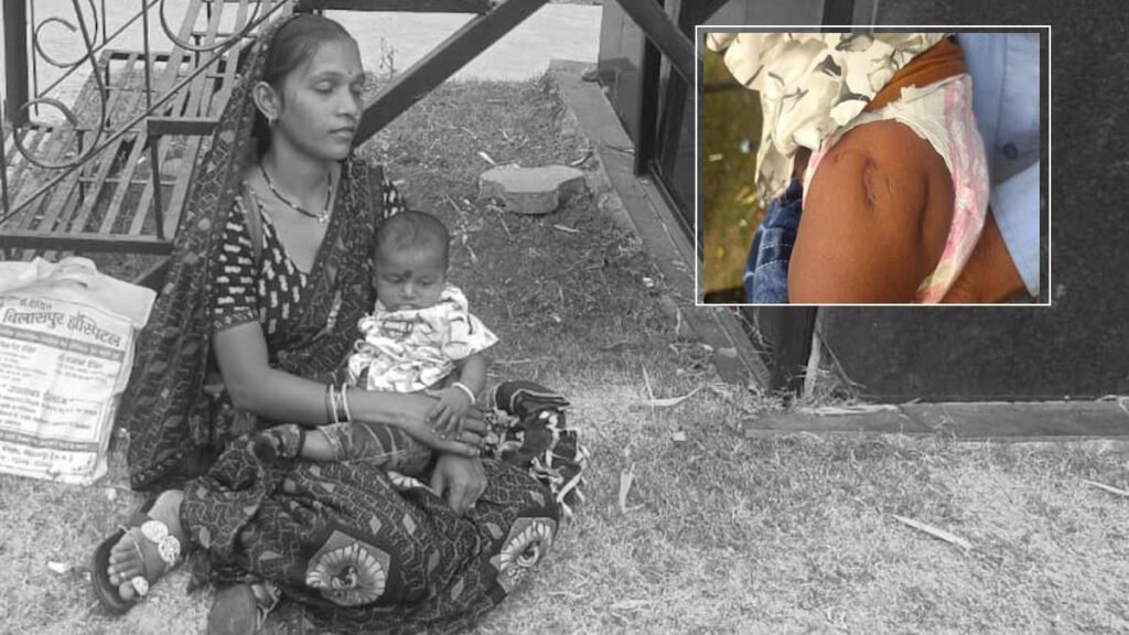 मुंगेली:टीका लगने के बाद नवजात के पैर में हुआ गंभीर इंफेक्शन, कर्ज लेकर कराया उपचार, डॉक्टरों के जवाब से हताश माता-पिता अब सरकार से लगा रहे गुहार…
