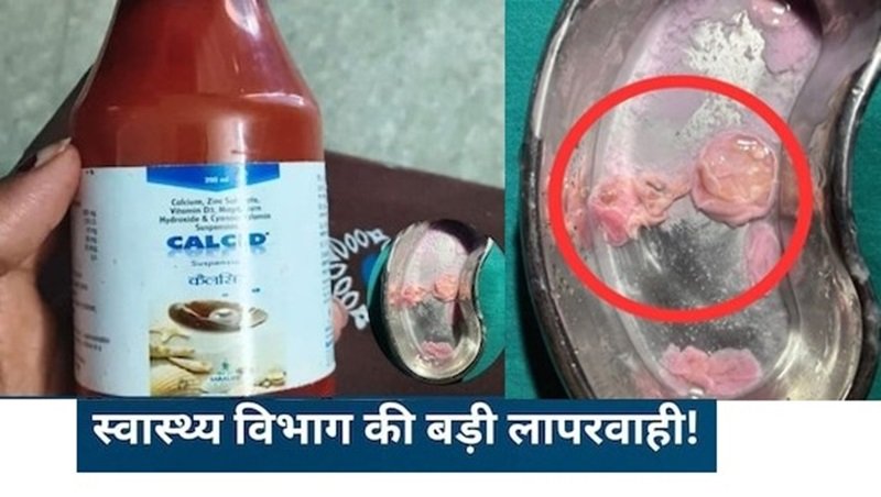 गर्भवती महिला को दी गई कैल्सिड सिरप में निकला मांस जैसा टुकड़ा…!