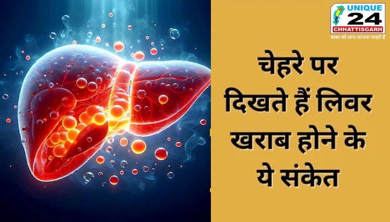 लिवर खराब होने के संकेत चेहरे पर दिखते हैं…