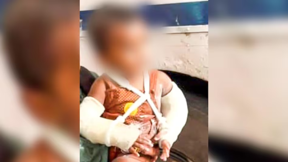 इंसानियत शर्मसार…! डेढ़ साल के मासूम के शरीर पर 51 जख्म…